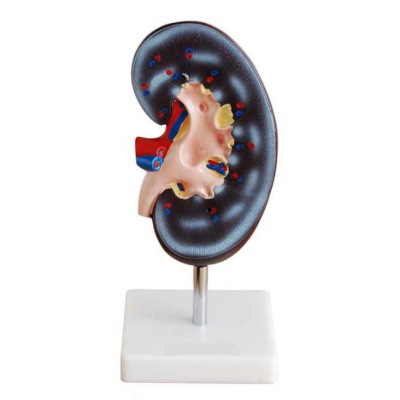 Mô hình giải phẫu thận 1 phần XC-310-1