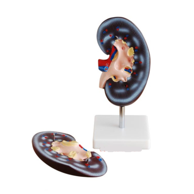 Mô hình giải phẫu thận người 2 phần XC-310-2