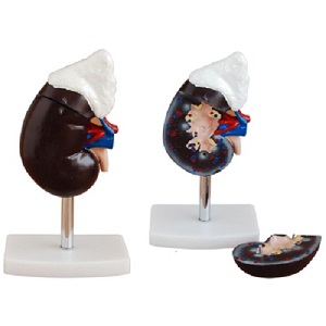 Mô hình thận người có tuyến thượng thận XC-310-3