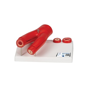 Mô hình xơ cứng động mạch với mặt cắt động mạch 2 phần 1000278 3B Scientific